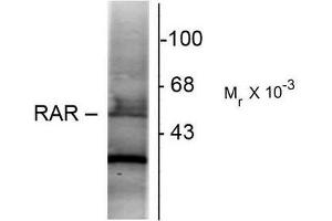 Western Blotting (WB) image for anti-Retinoic Acid Receptor, alpha (RARA) (N-Term) antibody (ABIN371837) (Retinoic Acid Receptor alpha Antikörper  (N-Term))