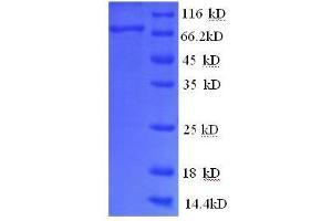 SDS-PAGE (SDS) image for Glucose-6-Phosphate Isomerase (GPI) (AA 2-554), (partial) protein (His tag) (ABIN1047072)