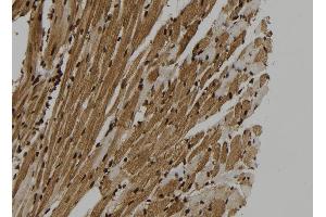 ABIN6265365 and ABIN6273325 at 1/100 staining Mouse heart tissue by IHC-P.