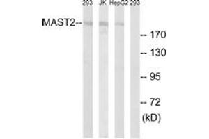 Western Blotting (WB) image for anti-Microtubule Associated serine/threonine Kinase 2 (MAST2) (AA 1201-1250) antibody (ABIN2889643) (MAST2 Antikörper  (AA 1201-1250))