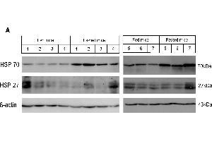 Western blot analysis of heat shock protein expression in fasted mouse livers. (HSP70 Antikörper)