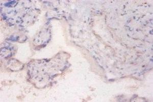 Immunohistochemistry of paraffin-embedded human placenta tissue using ABIN7168200 at dilution of 1:100 (RPS6KB2 Antikörper  (AA 1-210))