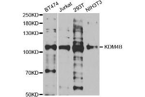 Western blot analysis of extracts of various cell lines, using KDM4B antibody.