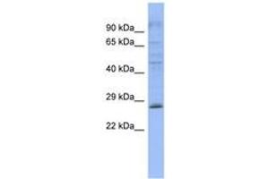 Image no. 1 for anti-Pleckstrin Homology Domain Containing, Family B (Evectins) Member 2 (PLEKHB2) (AA 143-192) antibody (ABIN6743268) (PLEKHB2 Antikörper  (AA 143-192))