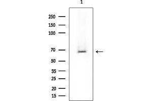 anti-Leiomodin 2 (LMOD2) antibody