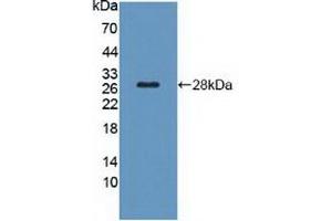 Figure. (TSH receptor Antikörper  (AA 28-245))