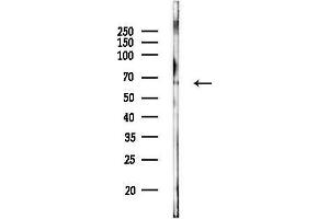 anti-EPS8-Like 3 (EPS8L3) antibody
