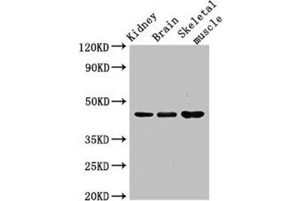 Caspase 4 Antikörper  (AA 82-226)