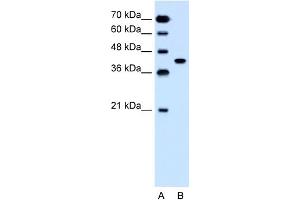 WB Suggested Anti-SLC35B1 Antibody Titration:  1. (SLC35B1 Antikörper  (C-Term))