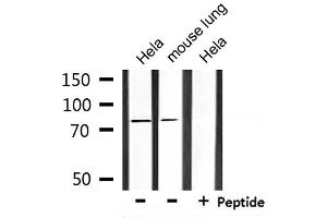 Western blot analysis of extracts from Hela and mouse lung, using SLC9A7 Antibody. (NHE7 Antikörper  (Internal Region))