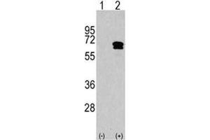 Western blot analysis of CAMKK2 antibody and 293 cell lysate either nontransfected (Lane 1) or transiently transfected with the CAMKK2 gene (2). (CAMKK2 Antikörper  (AA 483-512))