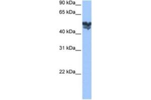 Western Blotting (WB) image for anti-WAS Protein Family, Member 3 (WASF3) antibody (ABIN2463503) (WASF3 Antikörper)