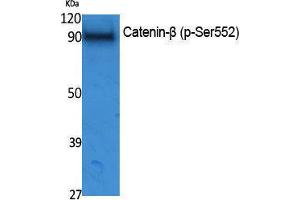 Western Blotting (WB) image for anti-Catenin, beta (CATNB) (pSer552) antibody (ABIN3183072) (beta Catenin Antikörper  (pSer552))
