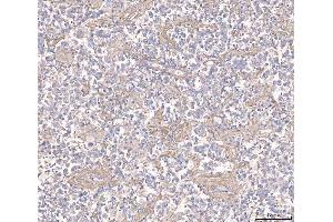 IHC analysis of ANGPT2 using anti-ANGPT2 antibody (ABIN3043725).