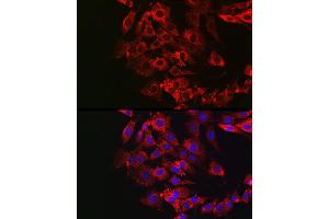 Immunofluorescence analysis of NIH/3T3 cells using GSDME antibody (ABIN6127757, ABIN6139554, ABIN6139555 and ABIN6223304) at dilution of 1:50. (Non-Syndromic Hearing Impairment Protein 5 (GSDME) (AA 1-260) Antikörper)
