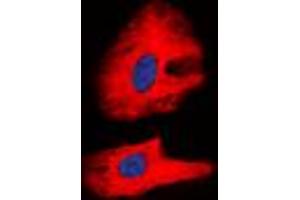 Immunofluorescent analysis of RET (pY1062) staining in K562 cells. (Ret Proto-Oncogene Antikörper  (C-Term, pTyr1062))