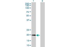 Western Blot analysis of METTL10 expression in transfected 293T cell line by METTL10 MaxPab polyclonal antibody. (METTL10 Antikörper  (AA 1-192))