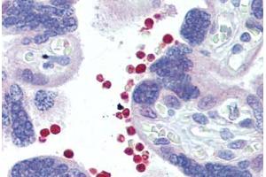 Placenta, red blood cells, Human: Formalin-Fixed, Paraffin-Embedded (FFPE) (AKT1/2 Antikörper)