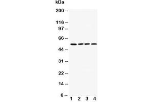 Western blot testing of AChR antibody and Lane 1:  rat brain;  2: mouse brain;  3: U87;  4: SHG-44;  5: Neuro-2a;  6: HeLa cell lysate