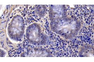 Immunohistochemistry (IHC) image for anti-Caspase 6, Apoptosis-Related Cysteine Peptidase (CASP6) (AA 194-293) antibody (ABIN7437107)