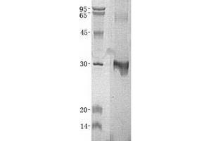 Western Blotting (WB) image for MOB Family Member 4, Phocein (MOBKL3) (Transcript Variant 3) protein (His tag) (ABIN2726215)