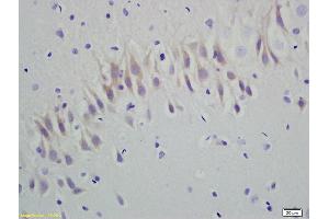 Formalin-fixed and paraffin embedded rat brain labeled with Anti-RGS5 Polyclonal Antibody, Unconjugated (ABIN680803) at 1:200 followed by conjugation to the secondary antibody and DAB staining (RGS5 Antikörper  (AA 81-181))