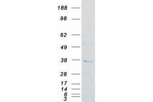 Western Blotting (WB) image for Fructosamine 3 Kinase Related Protein (FN3KRP) protein (Myc-DYKDDDDK Tag) (ABIN2724151)