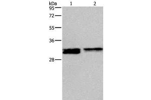 Western Blot analysis of Hela and Jurkat cell using FOSL1 Polyclonal Antibody at dilution of 1:615 (FOSL1 Antikörper)