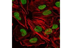 Immunofluorescence analysis of HeLa cells using XRCC5 monoclonal antobody, clone 5C5  (green).