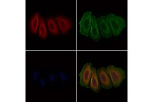 ABIN6266217 and ABIN6277375 staining Hela cells by IF/ICC.