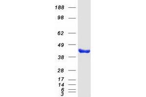 Validation with Western Blot (Eukaryotic Translation Initiation Factor 3, Subunit M (EIF3M) protein (Myc-DYKDDDDK Tag))