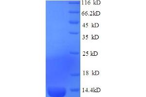 SDS-PAGE (SDS) image for Natriuretic Peptide Receptor B/guanylate Cyclase B (Atrionatriuretic Peptide Receptor B) (NPR2) (AA 22-106) protein (GST tag) (ABIN4976826) (NPR2 Protein (AA 22-106) (GST tag))