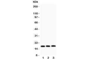 Western blot testing of FHIT antibody and Lane 1:  HT1080;  2: SW620;  3: Jurkat. (FHIT Antikörper  (AA 1-147))