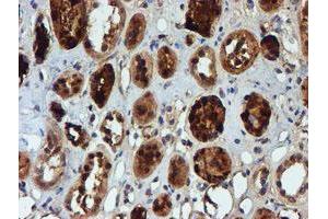 Immunohistochemical staining of paraffin-embedded Human Kidney tissue using anti-NQO2 mouse monoclonal antibody. (NQO2 Antikörper)