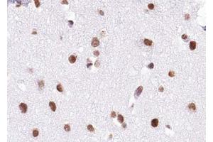 ABIN6272938 at 1/100 staining human brain tissue sections by IHC-P.