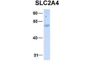 Western Blotting (WB) image for anti-Solute Carrier Family 2 (Facilitated Glucose Transporter), Member 4 (SLC2A4) (N-Term) antibody (ABIN2781558)