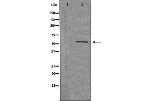 Western blot analysis of extracts from HeLa cells, using CHRNB1 antibody. (CHRNB1 Antikörper  (N-Term))