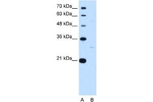 WB Suggested Anti-TEF Antibody Titration:  0. (TEF Antikörper  (N-Term))
