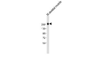 Anti-MYH1 Antibody (N-term)at 1:2000 dilution + mouse skeletal muscle lysates Lysates/proteins at 20 μg per lane. (MYH1 Antikörper  (N-Term))