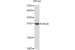 Western blot analysis of extracts of rat eye, using CPLX4 antibody (ABIN6291614) at 1:3000 dilution. (Complexin 4 Antikörper)