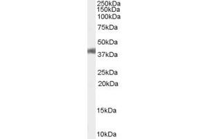 Image no. 2 for anti-Angiotensin II Receptor, Type 1 (AGTR1) (Internal Region) antibody (ABIN190902)