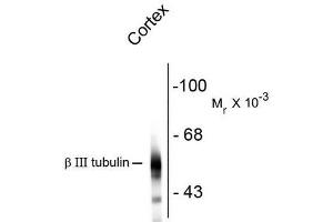 Western Blotting (WB) image for anti-Tubulin, beta 3 (TUBB3) antibody (ABIN371847) (TUBB3 Antikörper)