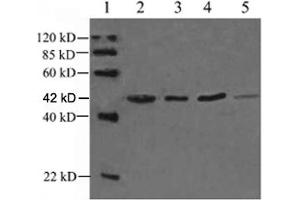 Lane 1: EasyWestern Protein Standard   Lane 2: Rabbit muscular tissue lysateLane 3: Fish tissue lysateLane 4: Hela cell lysateLane 5: Rat brain lysate Primary antibody: 1 µg/mL Rabbit Anti-alpha-Actin-1 Polyclonal Antibody (ABIN398560) The result was developed with One-Step WesternTM Complete Kit (Rabbit) (ABIN491509) (Actin Antikörper)