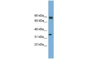 WB Suggested Anti-Ehf Antibody Titration:  0. (EHF Antikörper  (Middle Region))