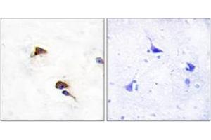 Immunohistochemistry analysis of paraffin-embedded human brain tissue, using PPIF Antibody. (PPIF Antikörper  (AA 86-135))