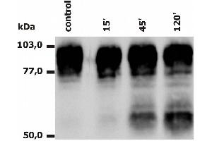 Western Blotting analysis of PMA-activated neutrophils (Fig. (Integrin beta 2 Antikörper  (PE))