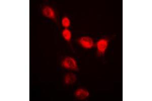 Immunofluorescent analysis of hnRNP A2/B1 staining in HeLa cells. (HNRNPA2B1 Antikörper  (N-Term))