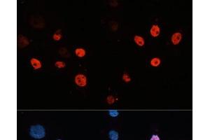 Immunofluorescence analysis of HeLa cells using HDAC3 Polyclonal Antibody at dilution of 1:100 (40x lens). (HDAC3 Antikörper)