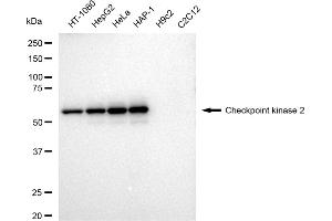 Western blotting analysis using Checkpoint kinase 2 antibody (ABIN7798039).
