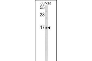 Western blot analysis of GMFG Antibody (N-term) (ABIN392351 and ABIN2841990) in Jurkat cell line lysates (35 μg/lane).